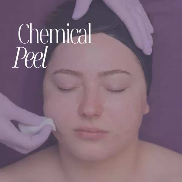 Mastering Chemical Peels Online Certification