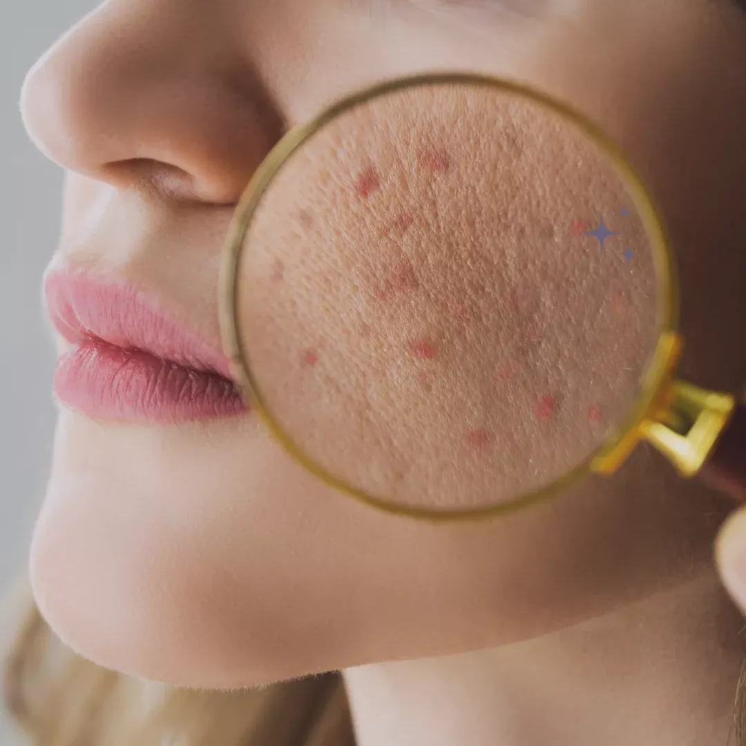 Skin Barrier Health and Repair Certification
