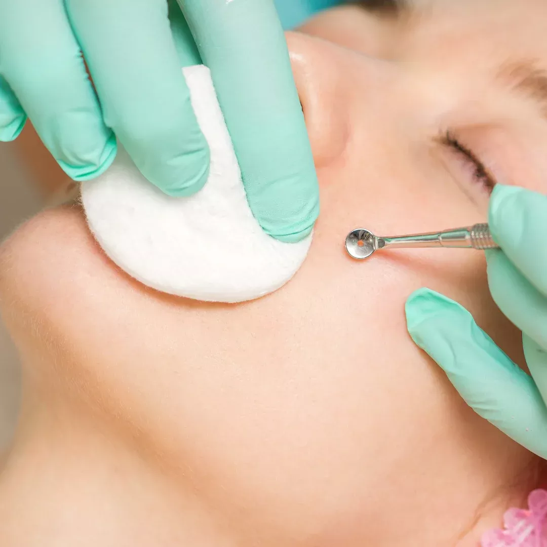 Stonhart Skin Presents: Mastering Extractions Workshop